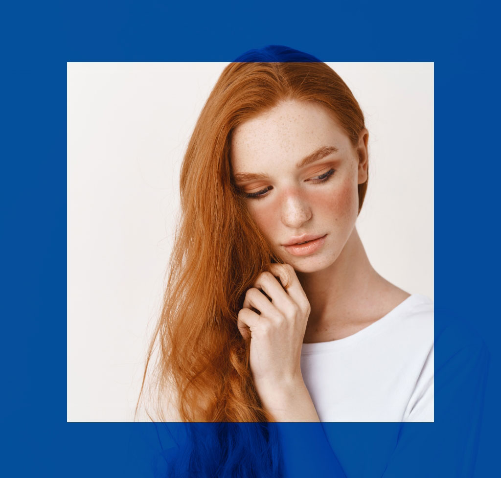 Immagine che raffigura una ragazza dai capelli rossi con evidentio segni della malattia autoimmune lupus.