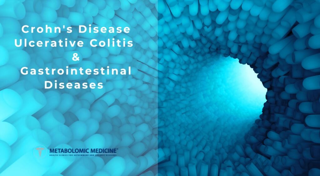 morbo-di-crohn-colite-ulcerosa-malattie-autoimmuni